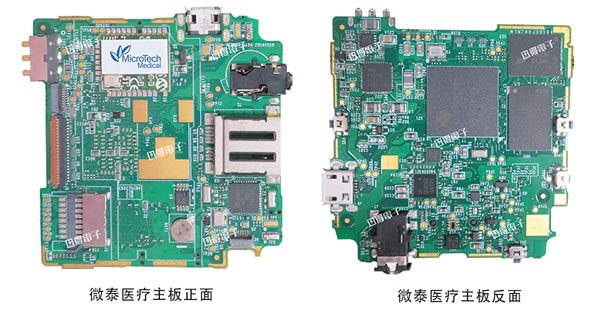 杭州迅得電子 | 微泰醫(yī)療設(shè)備主板組裝 | 可穿戴醫(yī)療設(shè)備電路板組裝服務(wù)